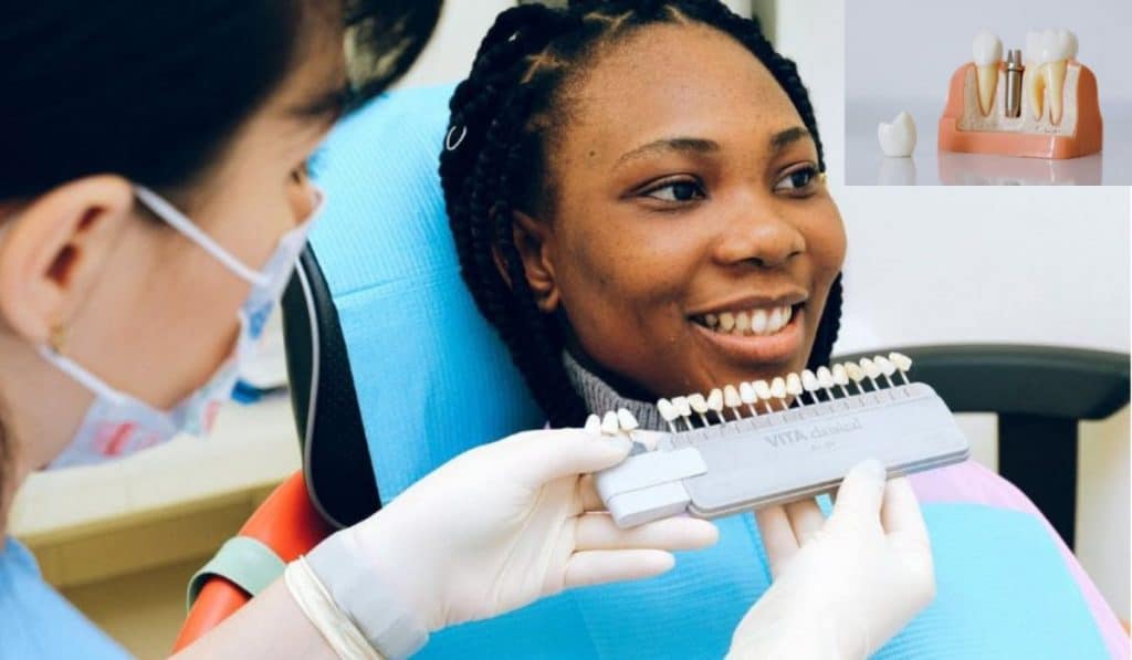 Implantes Dentales: Recuperar dientes perdidos es posible